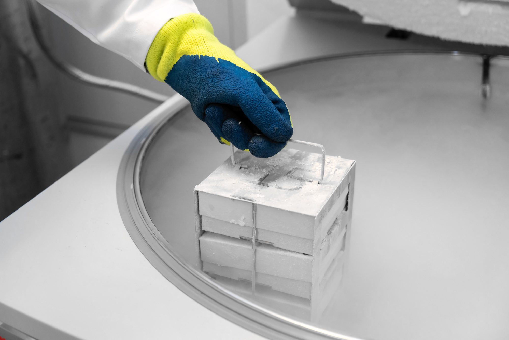 Featured image for ““Should I Bank My Stem Cells?” 6 Reasons Why It’s a Good Idea”